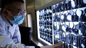 intelligenza artificiale può individuare malattie